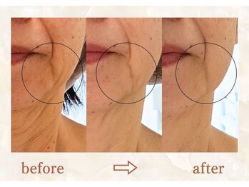 スリーエッセンス(3THREE ESSENCE)の写真/【あなた史上、もっと自信の持てる素肌へ】たるみ/シワ/小顔“自然な若見え”大人の本気エイジングケア