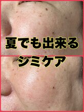 リーストア(Re:Store)/夏でも出来ます。