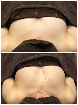 美人バスト 札幌店/バストアップ×育乳 &nbsp;◇症例◇