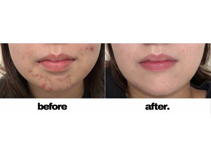 プリベンティブ ビューティー ティップス(Preventive Beauty Tips)の写真