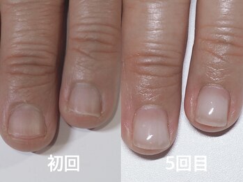 【深爪/自爪育成】