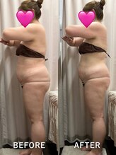 ベルミーランド マルエツ安行慈林/痩身Before→After