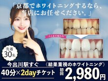 ホワイトニングショップ 今出川店(WHITENING SHOP)