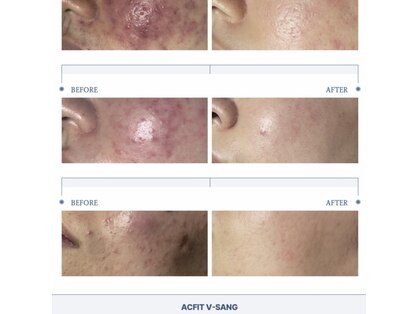 スキン ラボ ケー(Skin lab K)の写真