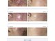 スキン ラボ ケー(Skin lab K)の写真