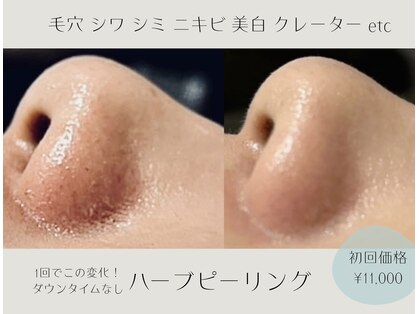アールエスト(R EST.)の写真