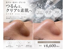 アルテ 神戸(Arte)の雰囲気（ハーブピーリング）