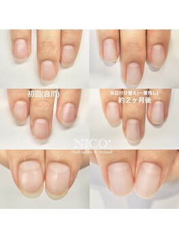 ニコプラス(NICO+)/自爪育成パラジェルクリア補強