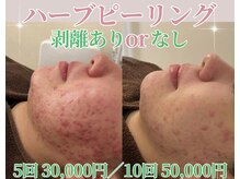 アイル 高槻店(iru)/お得な回数券もご用意！