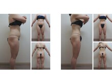 Nビューティー/最新エンダモロジーBODY