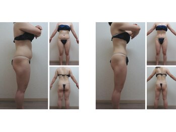 Nビューティー/最新エンダモロジーBODY