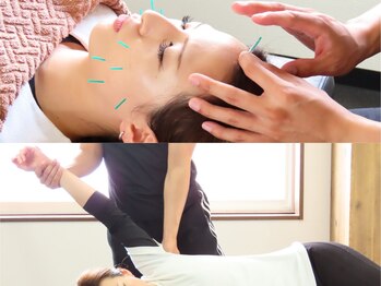 ワンドア(ONEDOOR)の写真/美容鍼と全身整体が同時に受けれちゃう！【初回135分/ベーシック美容鍼+全身整体◎¥12,000→¥9,700】