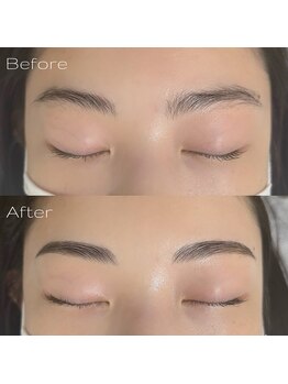 ビビ(BIBI)/お客様Before→After