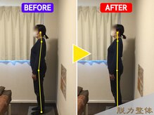 幸せのもり整体院/Rさん/女性