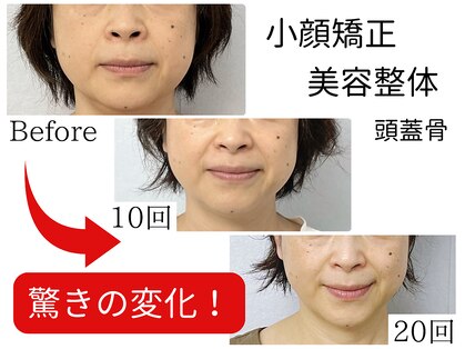 キュット(Qtto)の写真