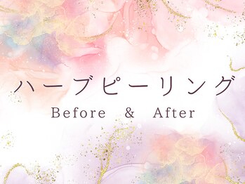 ココロ(COCORO)/ハーブピーリング