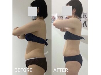 エスグレース 梅田店(S.grace)/痩身機器&燃焼リンパマッサージ