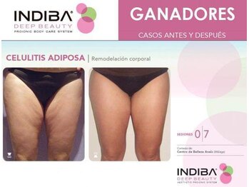 シュプリーム ラ ディオサ(Supreme LA DIOSA)/