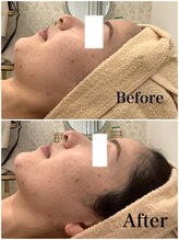 スペチアーレ 夙川/驚きの引き上がり