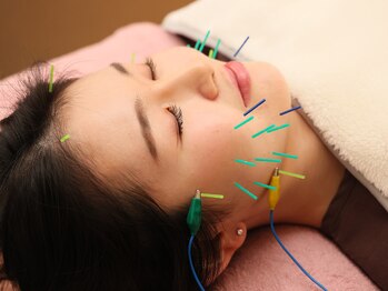 鍼灸サロン アヤカ(AYAKA)/小顔美容鍼◎