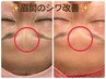 《怒ってる？なんて言わせない!!》ガンコな眉間にゴットハンドで立ち向かう★