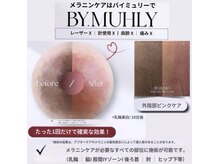 イクアイラッシュ(iku eyelash)の雰囲気（ニップルぴんく黒ずみケア!マツエクメンテ後30分で同時にVIOも）