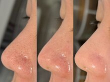 ルーナジェーナ(Luna llena)/