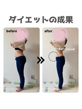 ファミール鍼灸整体院(famille鍼灸整体院)/体重マイナス12kg