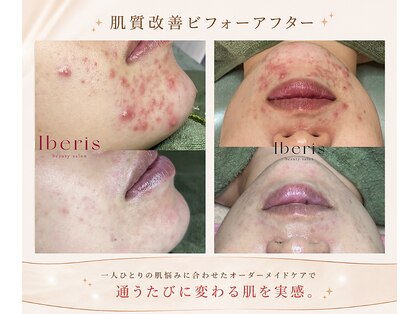 サンテ(Sante)の写真