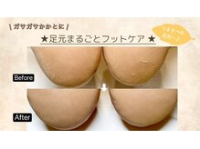 エムアール(MR)の雰囲気（かかとのガサガサが気になる方/足元をまるごとケア(担当こもも)）