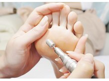 足爪甘皮処理＋足裏角質処理の大変珍しい組み合わせのフットケア