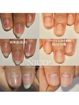 ニコプラス(NICO+)/自爪育成パラジェルクリア補強
