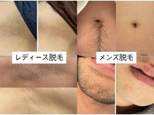 エクラ(eclat)の雰囲気（小学生から脱毛可能◎一回目から効果実感のお声多数☆）
