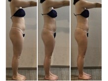 リーノ プロデュースド バイ ティービーピー 香里園店(Liino Produced by TBP)/初回/4回目/8回目