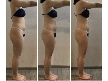 リーノ プロデュースド バイ ティービーピー 香里園店(Liino Produced by TBP)/初回/4回目/8回目