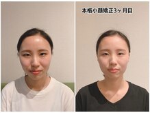 ビココ(美co co)の雰囲気（本格小顔矯正★20代お客様★姿勢まできれいになる♪）