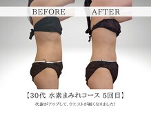 ヨサパーク ククナ 大塚(YOSA PARK kukuna)/痩身/ダイエット/よもぎ蒸し痩身