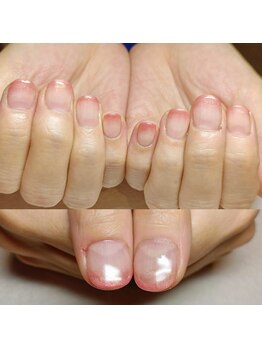 マニエネイル(mani e nail)/自爪育成ジェルネイル/深爪矯正