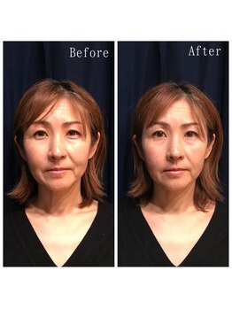 たくろう鍼灸院 豊田本院/Before＆After