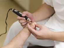 巻き爪矯正も受けられます！！