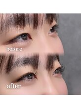 ディッチャ(Dicha)