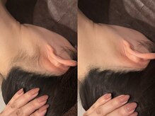 脱毛サロン Exsior.博多店 都度払い脱毛/全身脱毛/メンズ脱毛の雰囲気（全身脱毛初回6600円♪）