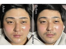 ダウニー(Downy)/20代/男性/営業マン