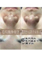 エステルーム クリスタル/贅沢たっぷりフルコース