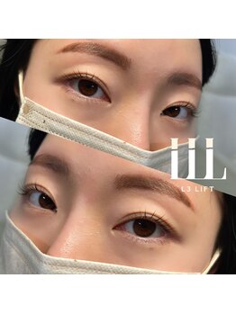 ジョリー(Jolie)/