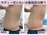 最新ボディー切らない脂肪分解◎お腹周りor太ももorお尻¥29,000→¥22,500！