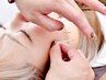 【ボト効きすぎ対処】表情が作れない、動かない効きすぎ悩みの軽減に美容鍼！