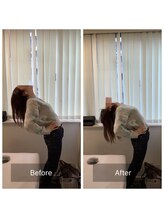 ナオル整体 新宿院(NAORU整体)/30代女性-猫背矯正Before/After