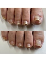 リリ(lili)/フットケア/ネイルスキンケア