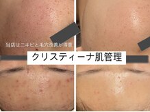 エクラ(eclat)の雰囲気（クリスティーナ施術で計画的に肌質改善◎お肌悩みお任せ下さい！）